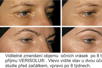 Bioaktivní peptidy VERISOL® a studie prokazující redukci vrásek